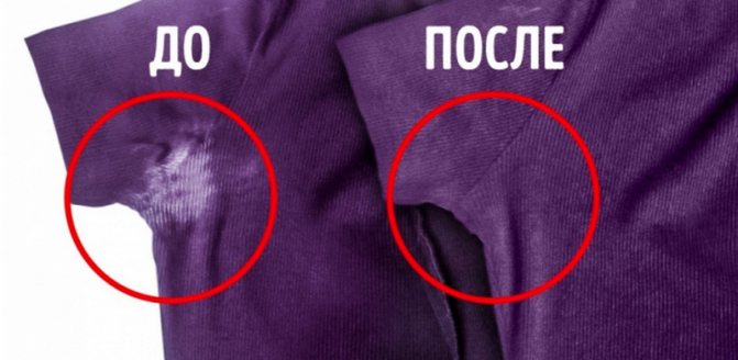 Способы выведения пятен от пота и дезодоранта с одежды